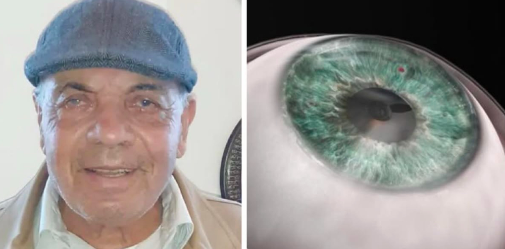 Yapay Kornea Nakli ile 10 Yıl Sonra Görmeye Başladı