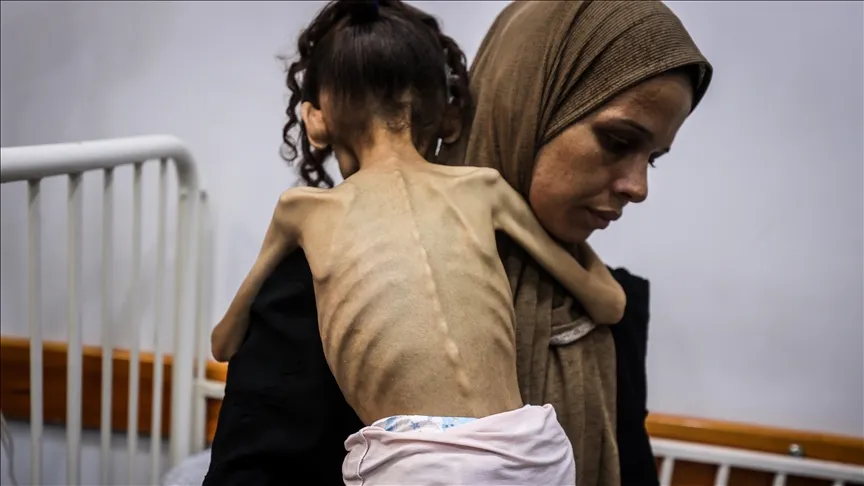İSRAİL’İN KITLIĞA SÜRÜKLEDİĞİ GAZZE’DE 9 YAŞINDAKİ MERYEM, 25 KİLODAN 10 KİLOYA DÜŞTÜ